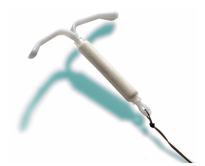 The IUD Makes a Comeback?